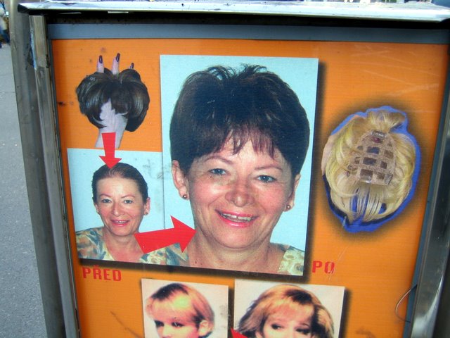 The Best 6 Houston Hair Transplant and Restoration Clinics